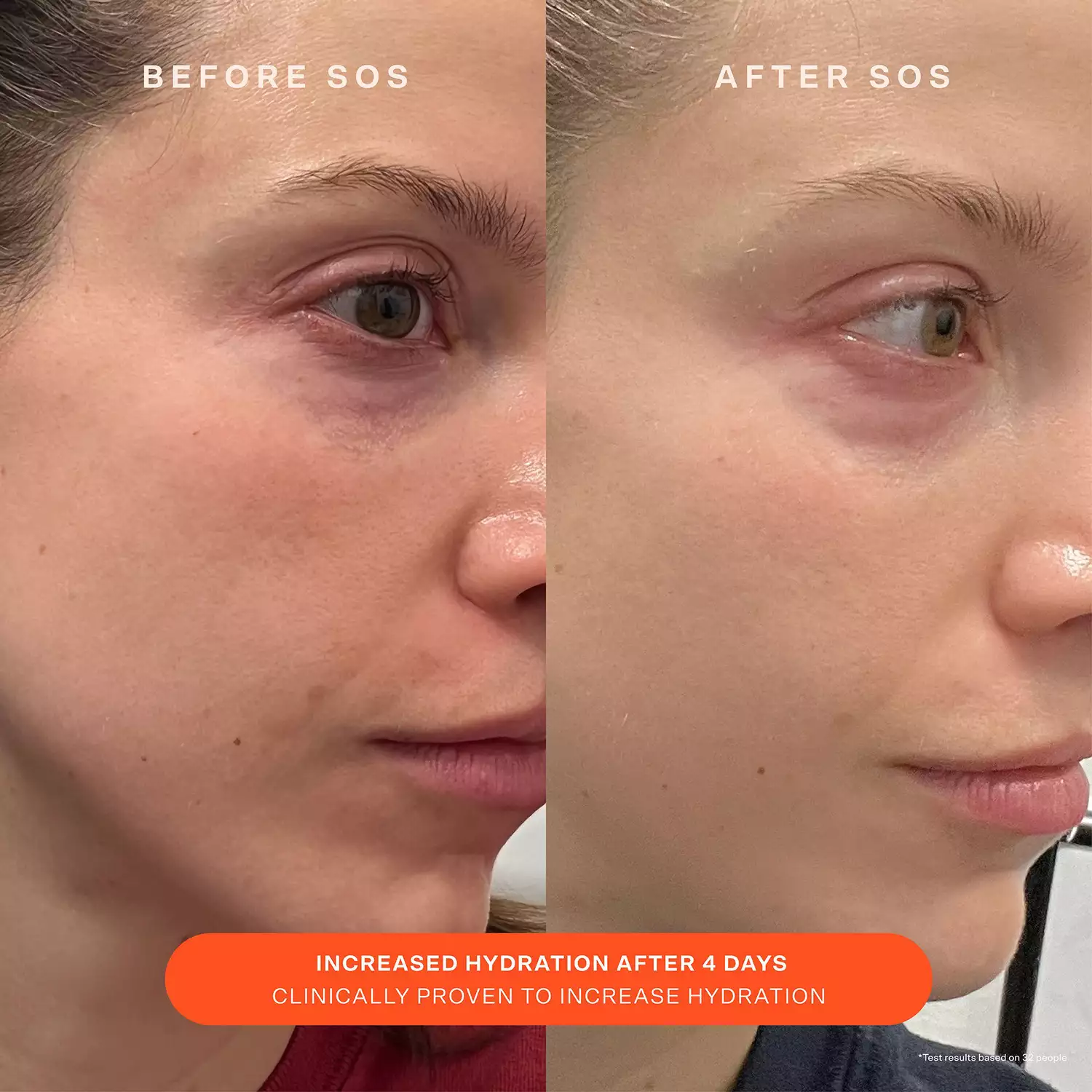 a person's skin before and after using the SOS Daily Barrier Recovery Cream 