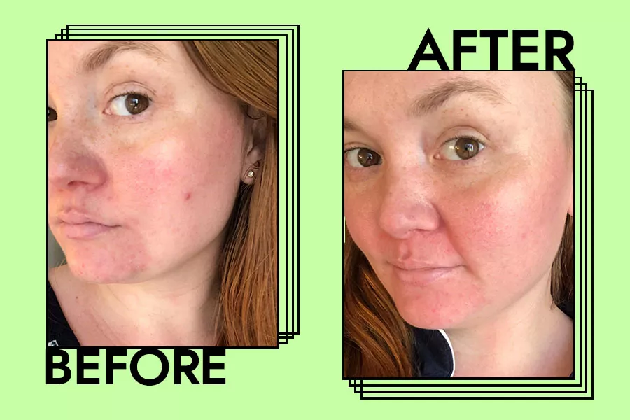 sunday riley clarifying oil before and after