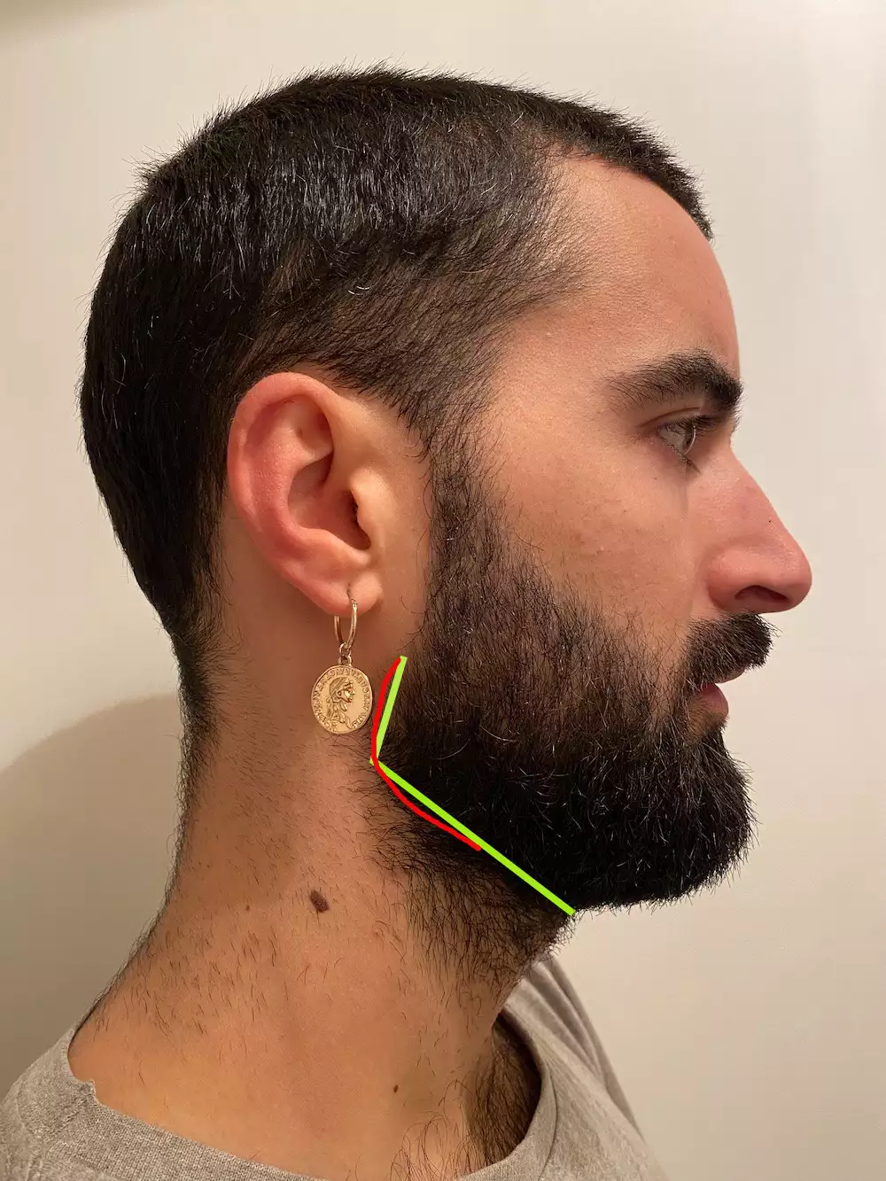A visual of a beard neckline.
