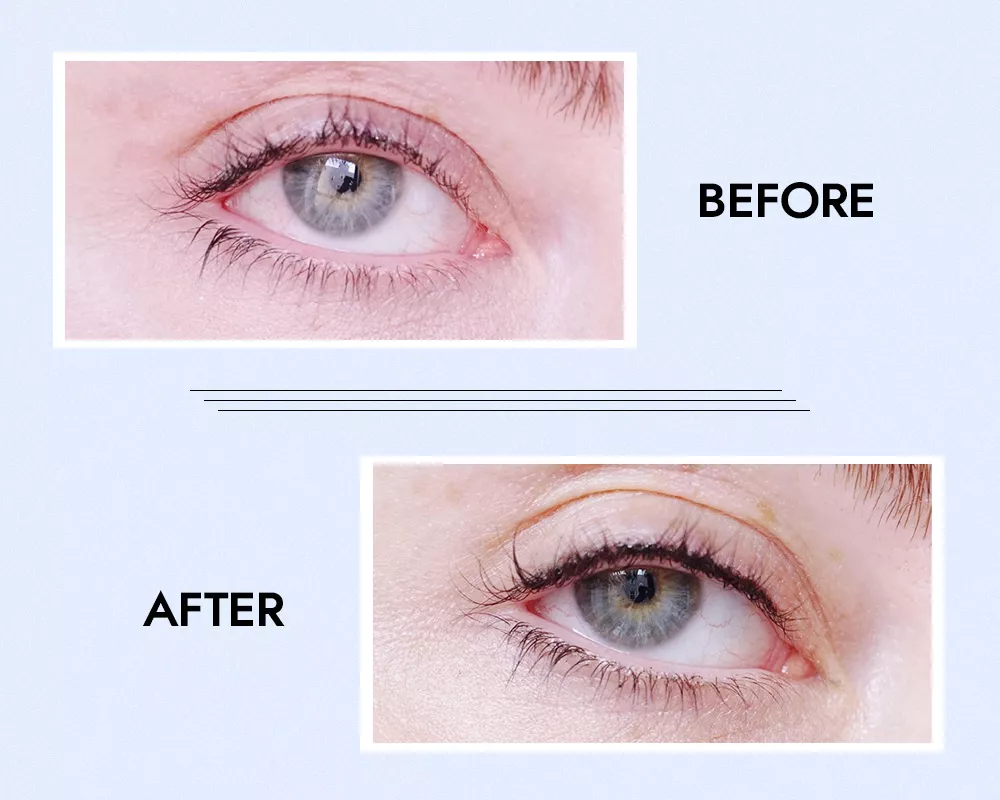 permanent eyeliner before and after