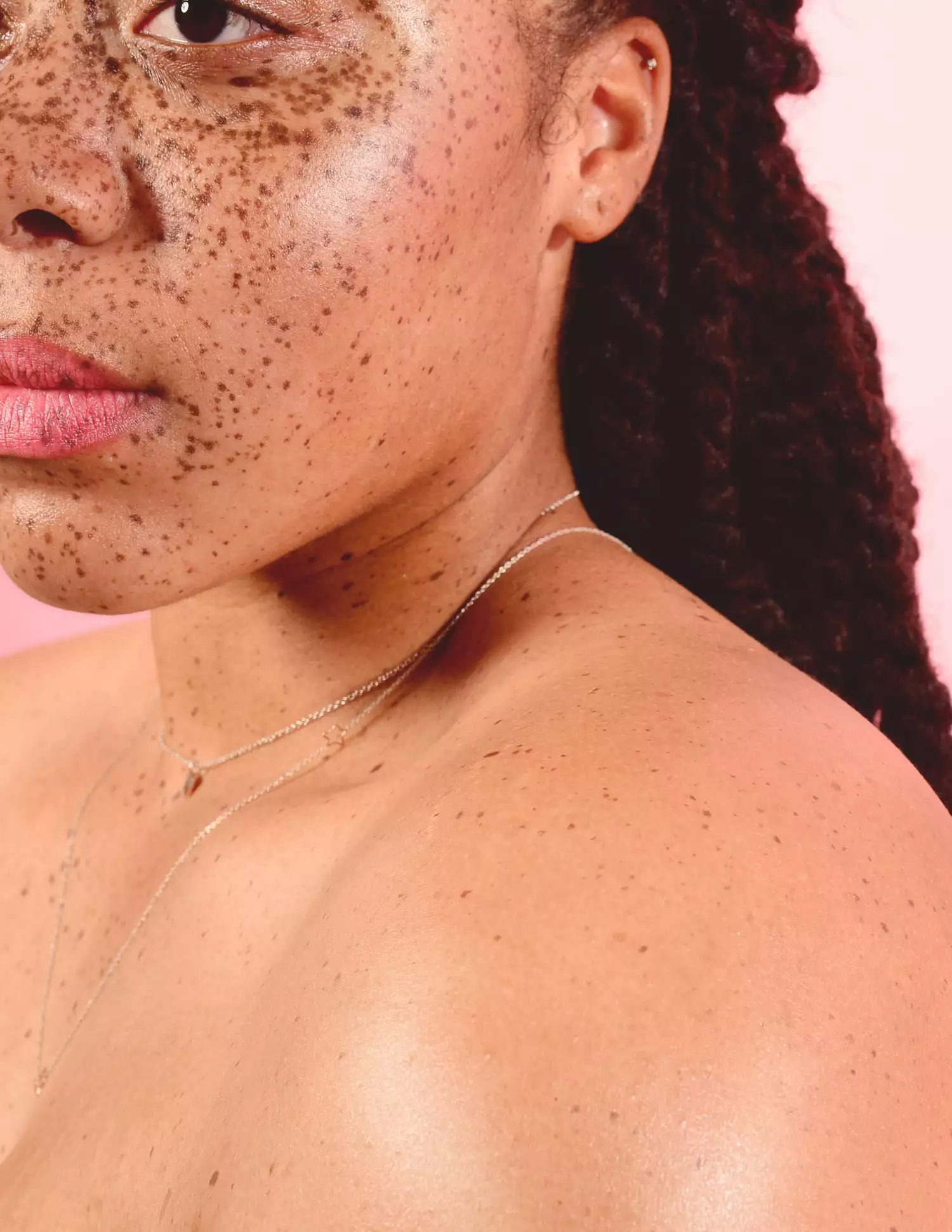 closeup portrait of woman with freckled skin and dreadlocs